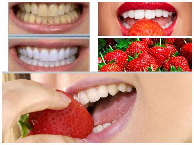 Como-blanquear-los-dientes-de-forma-natural-con-fresas | Ecología Hoy